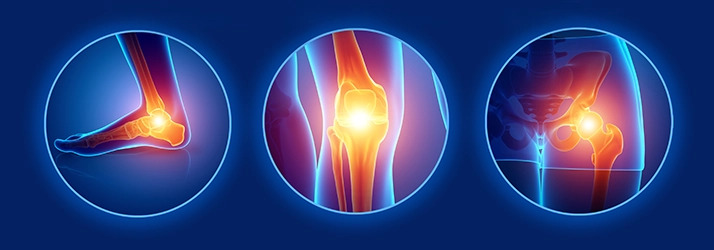 Depositphotos_145339713_XL Sciatica Pain