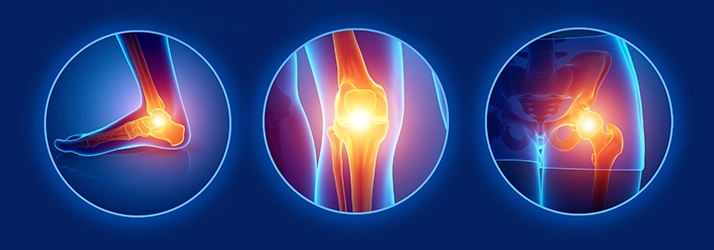 Depositphotos_145339713_XL Sciatica Pain